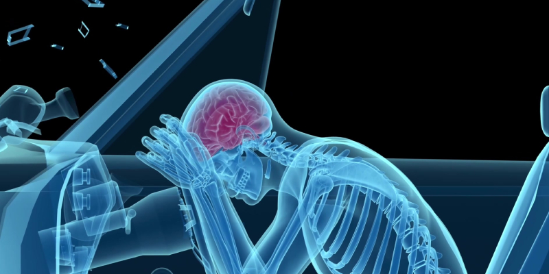 personal injury law - brain injury